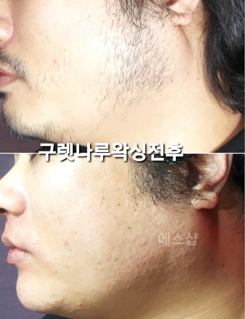 춘천왁싱에스샵왁싱 이미지
