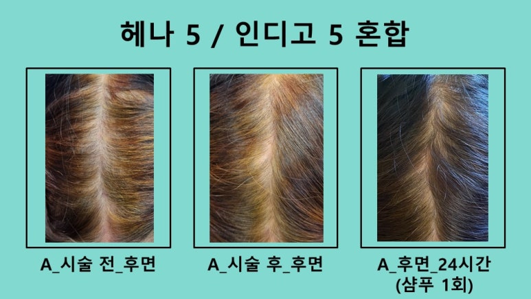 하라힐즈 이미지