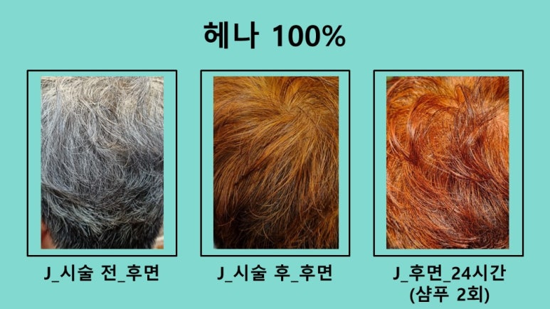 하라힐즈 이미지