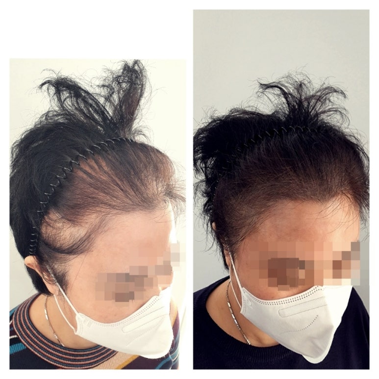 유나뷰티 이미지