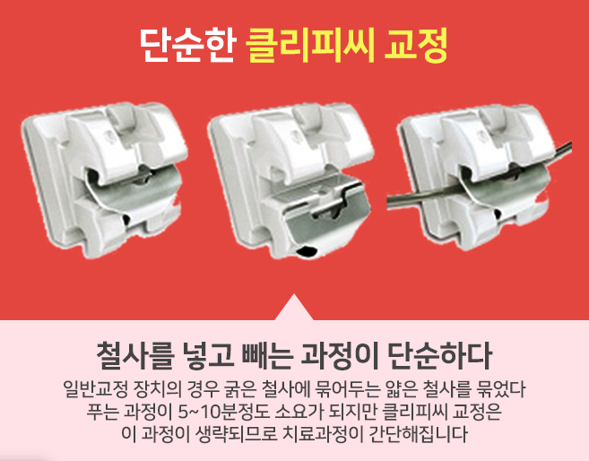 심플교정 이미지