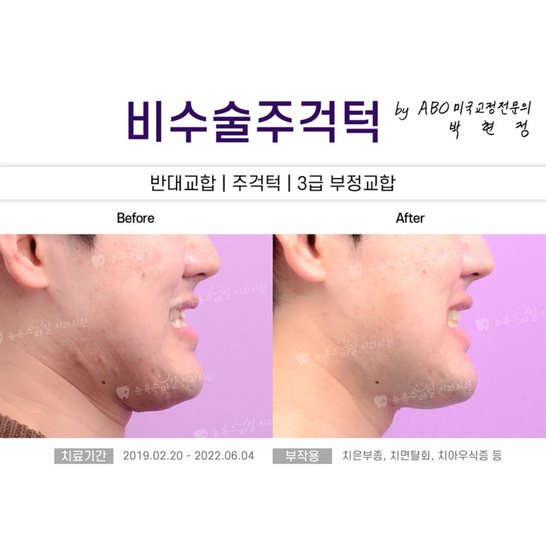 스마일치과의원 이미지