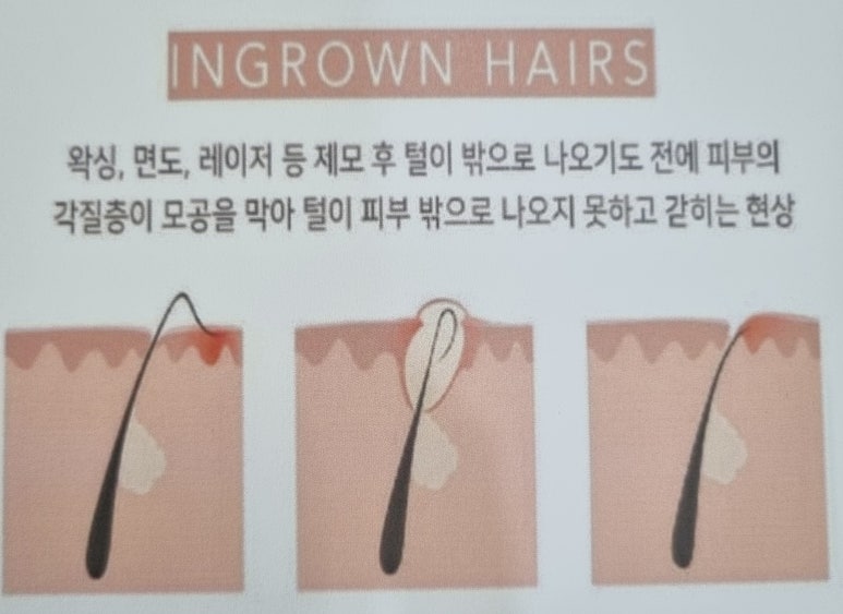 봄날홈케어 이미지