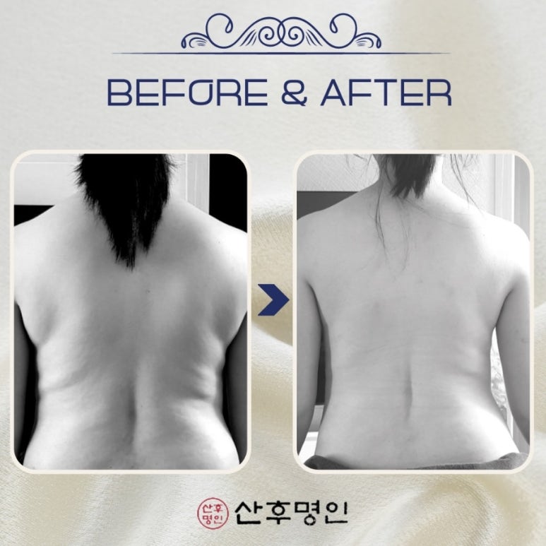 산후명인 이미지