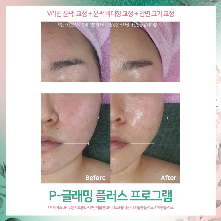 뷰티비젼 진주점 이미지