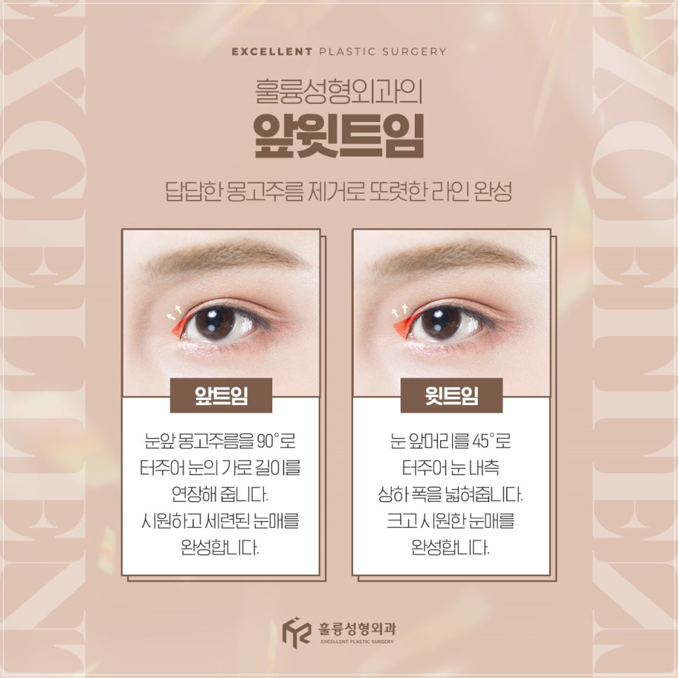 훌륭성형외과 이미지