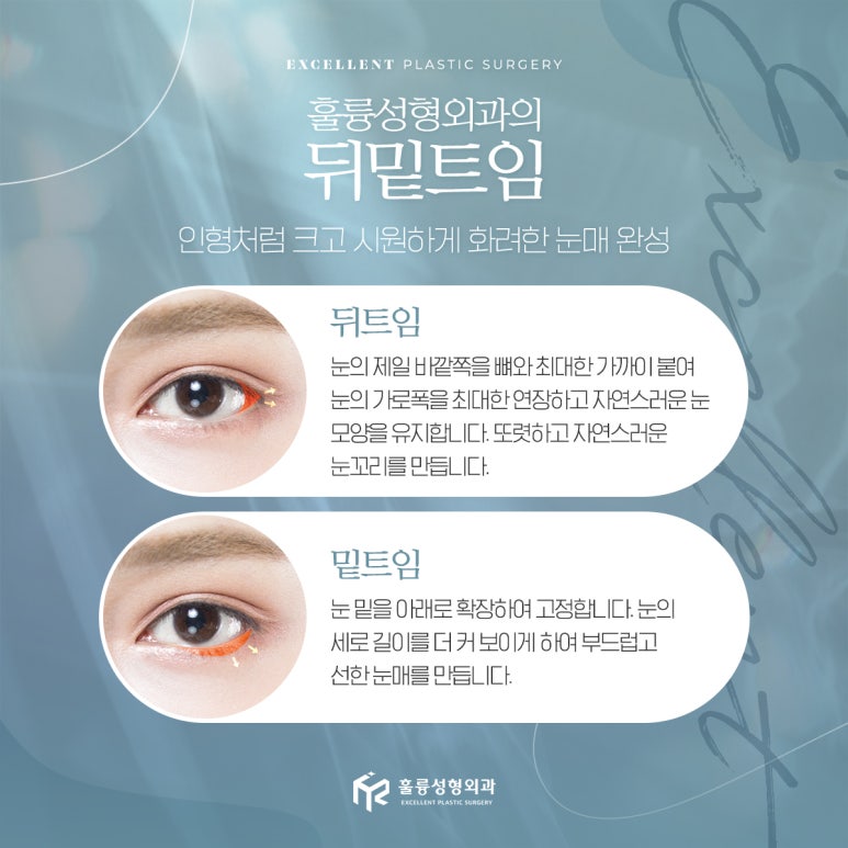 훌륭성형외과 이미지