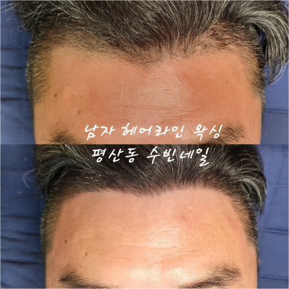 수빈헤어라인 이미지