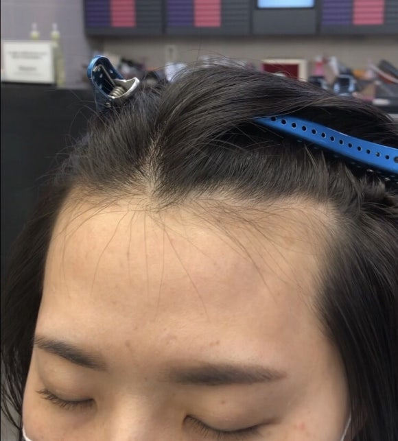 모모헤어라인 이미지