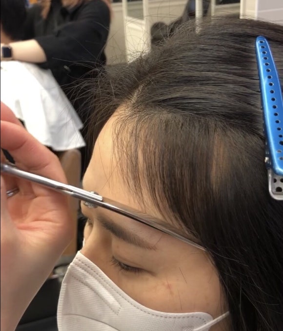 모모헤어라인 이미지