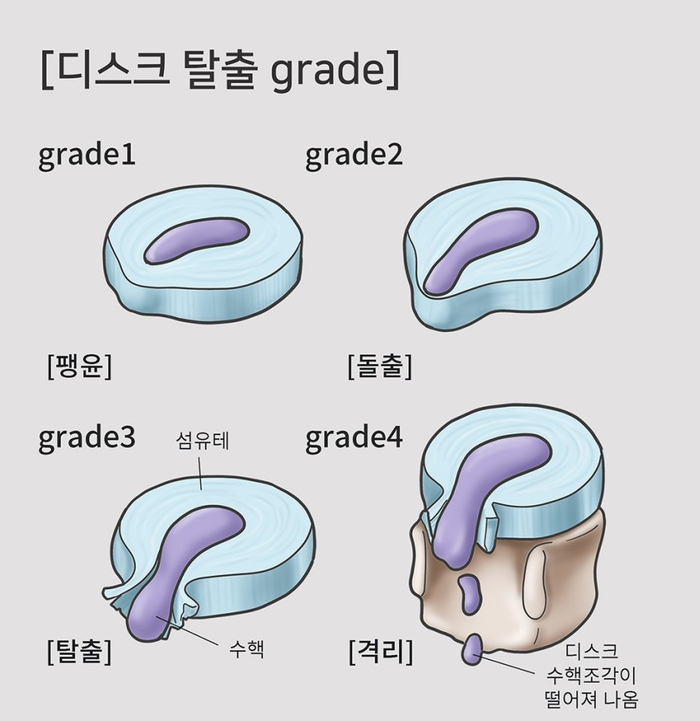 균형한의원 이미지