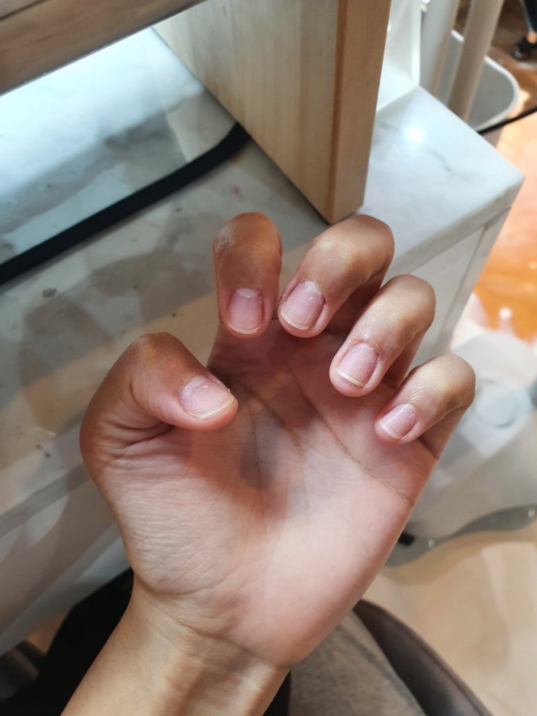 블리스네일 이미지