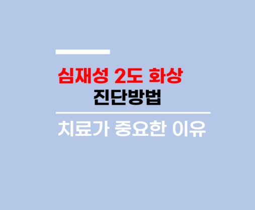 심재성 이미지