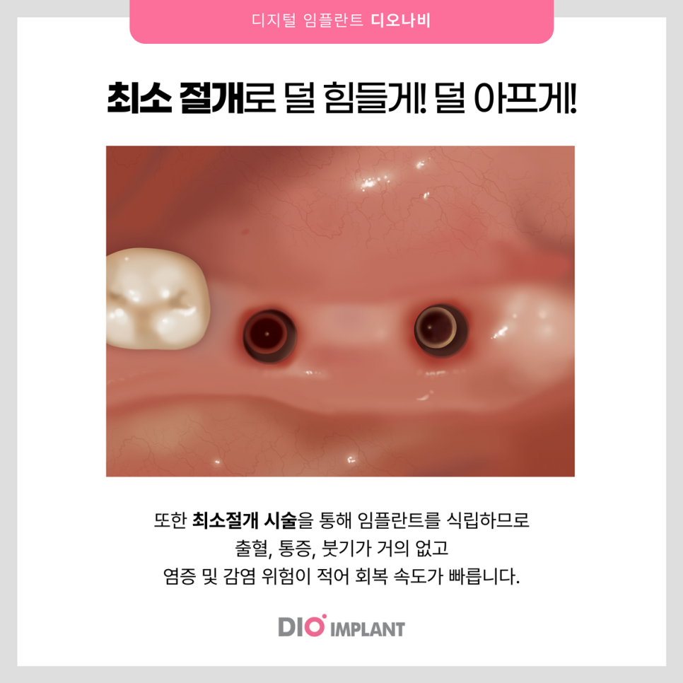 디오컴퓨터 이미지