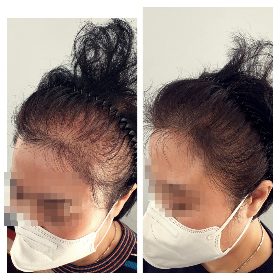 유나뷰티 이미지