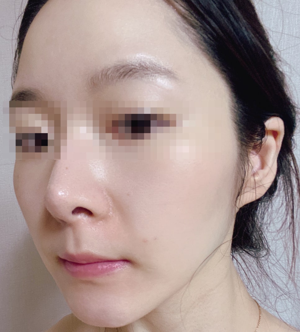 피씨케어 이미지