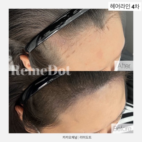 헤어팡팡&가발 이미지