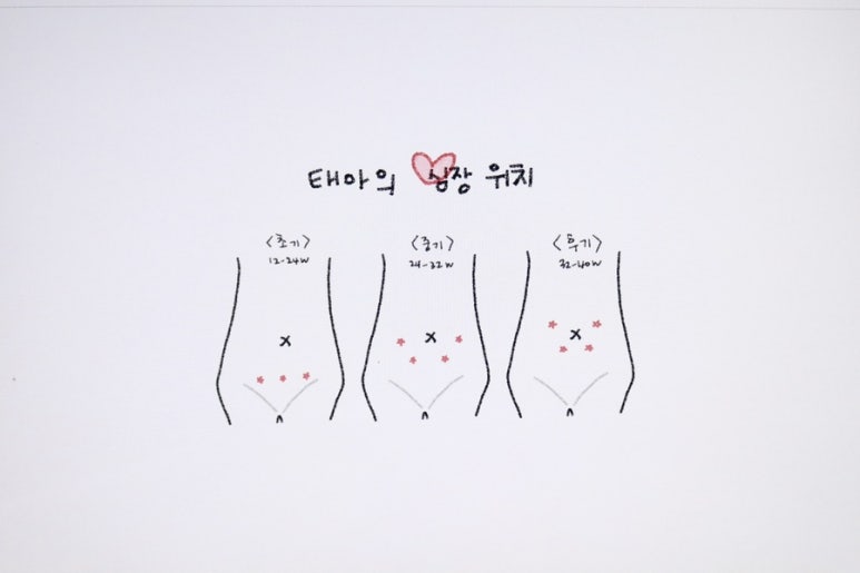하이베베 이미지