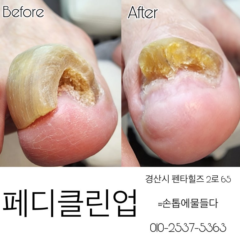샵 손톱에물들다&페디클린업 이미지