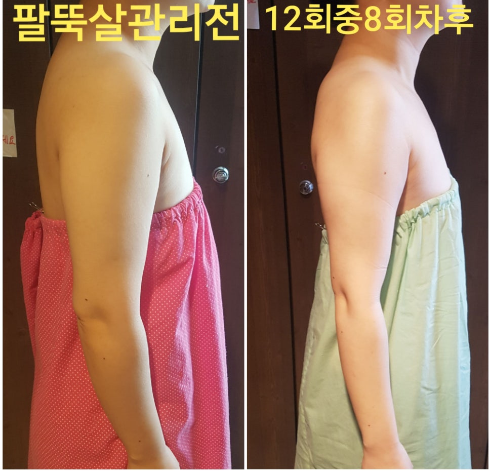 승바른체형 이미지