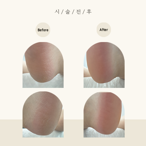 리풋 이미지