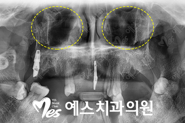 예스이치과의원 이미지