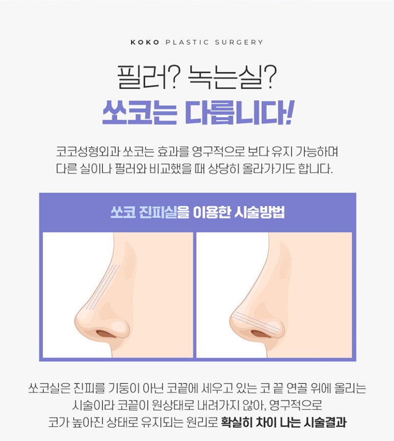 쏘코 이미지