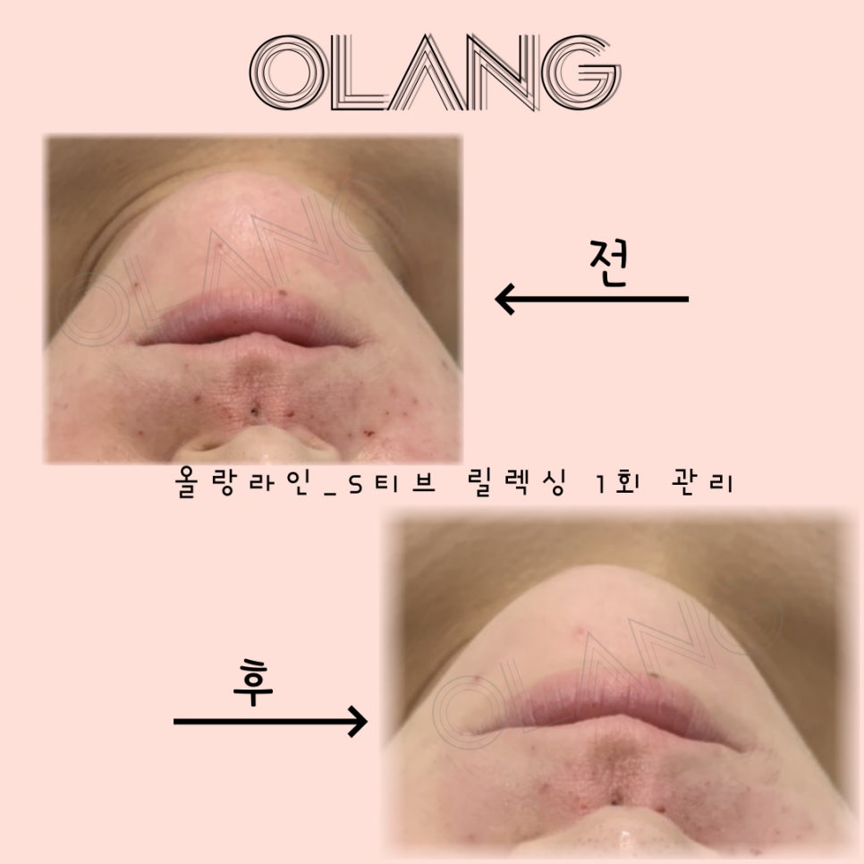 베네핏 에스테틱 이미지