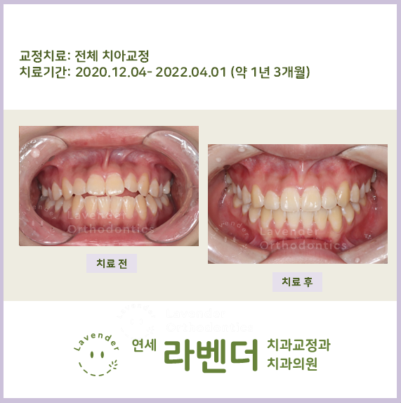 연세라벤더치과교정과치과의원 이미지