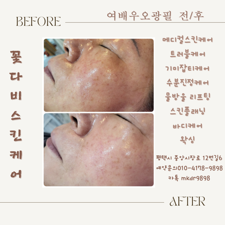 오광케어 이미지