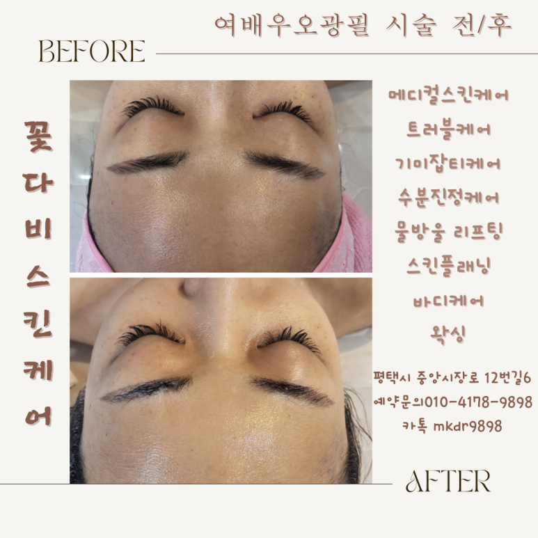 오광케어 이미지