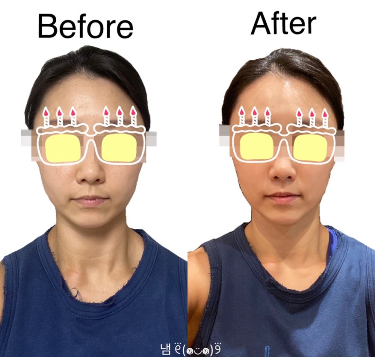 스마일데이지(Smile Daisy) 이미지