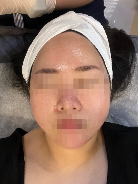 히엘뷰티 이미지