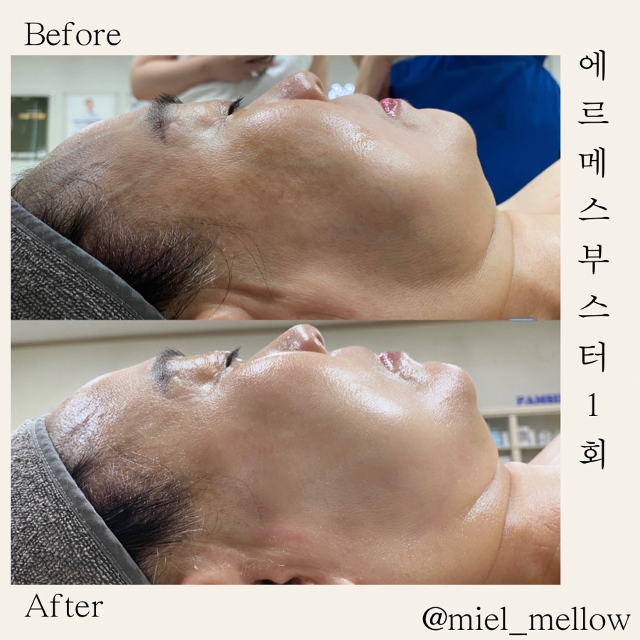 미엘성형외과 이미지