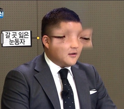 주드네일 이미지