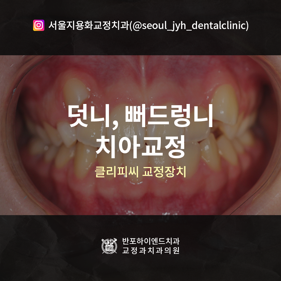 미소하나치과교정과치과의원 이미지