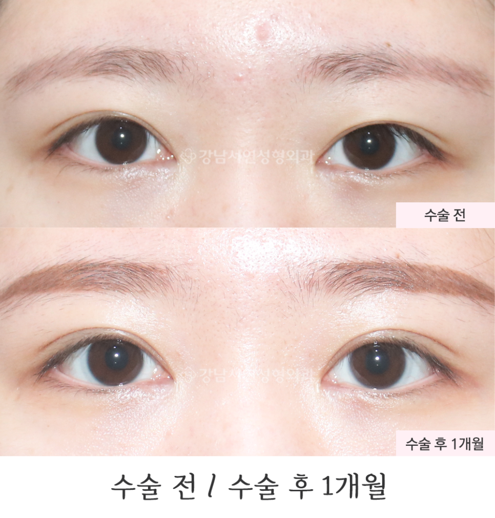 서연성형외과의원 이미지