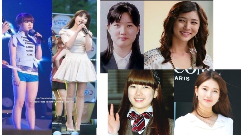 에소코핏 대구동천점 이미지