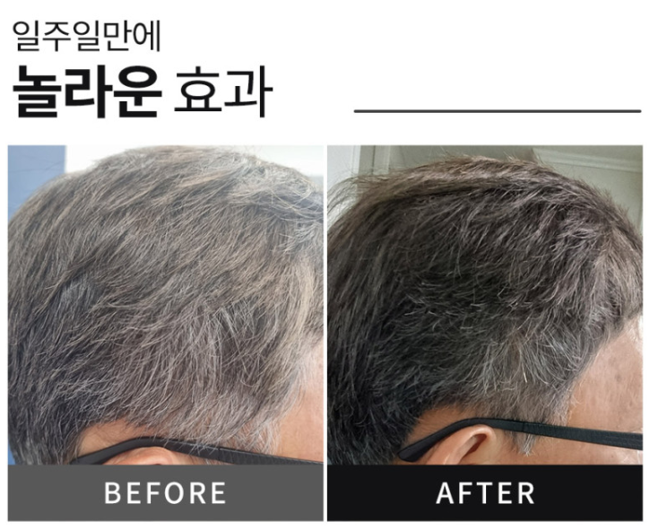 새치와까망머리 이미지