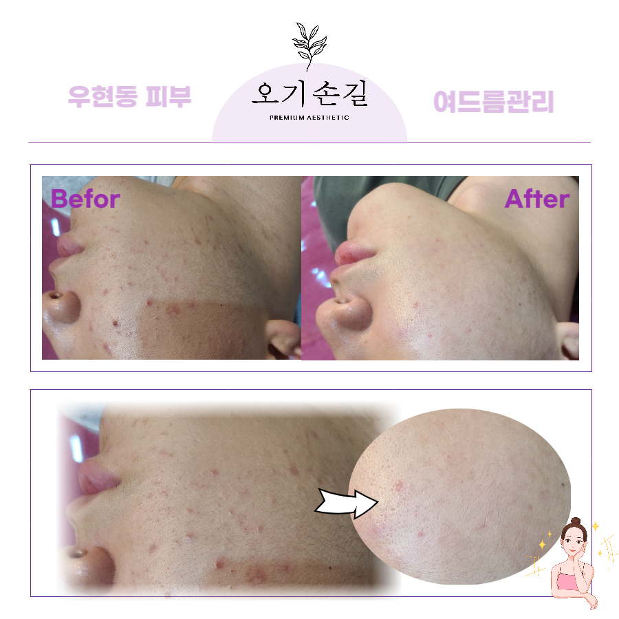 오기손길 이미지