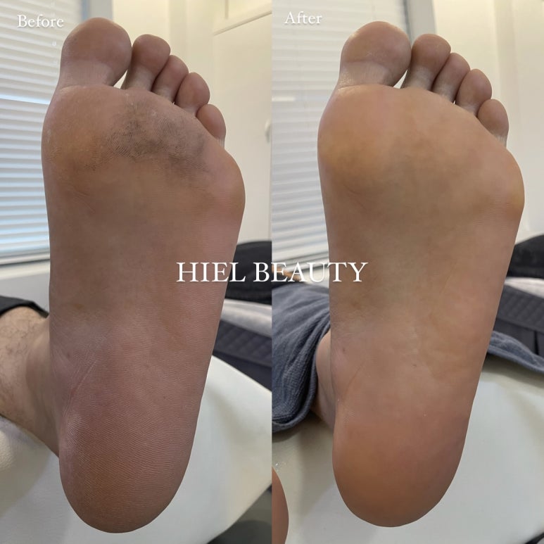 히엘뷰티 이미지