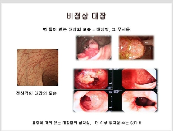더샵짱 이미지