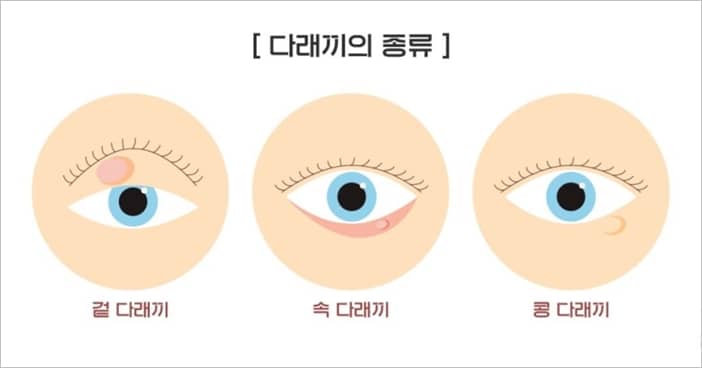 서울아이센터안과의원 이미지
