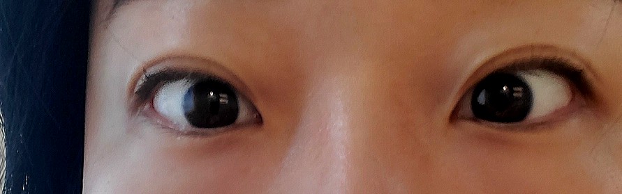 요이뷰티 이미지