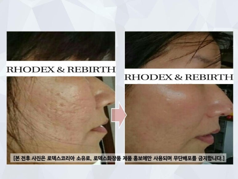 로덱스 이미지