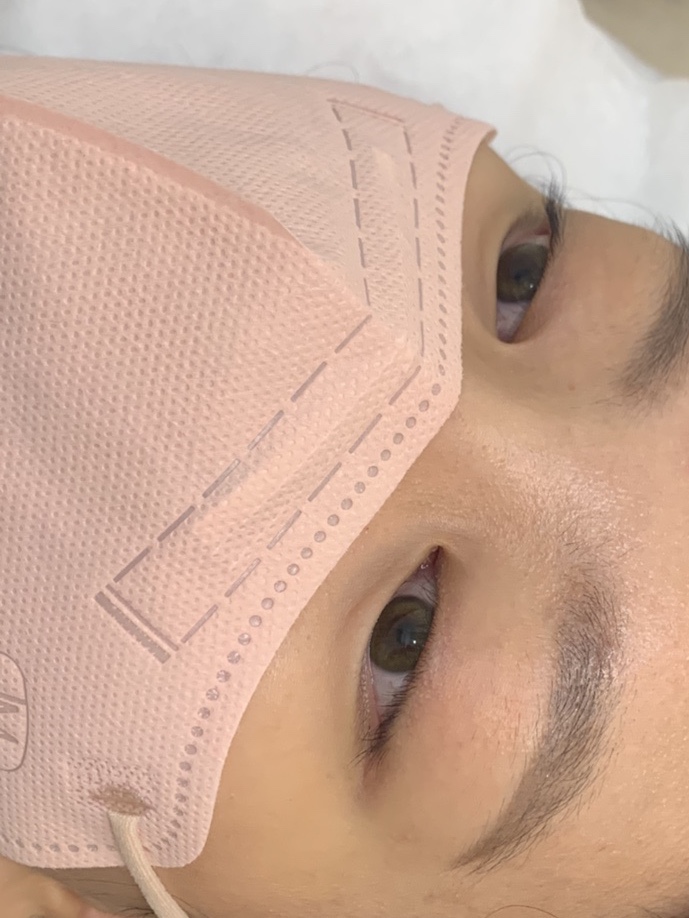 멜로래쉬 이미지