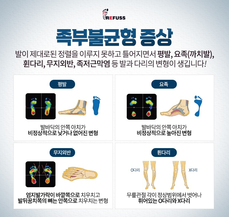 레푸스 이미지