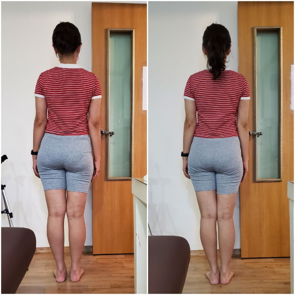 금손체형관리 이미지