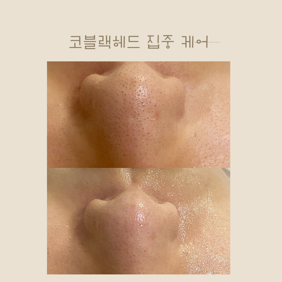 미랑뷰티 이미지