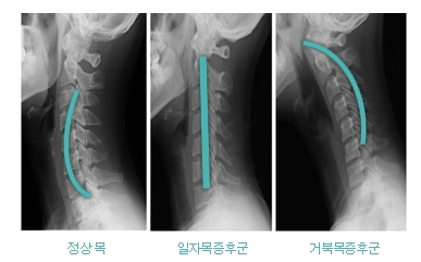짐포유 이미지